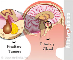 Location of Pituitary Gland with Tumor