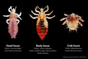 these are the physical differences in pubic lice and head lice.