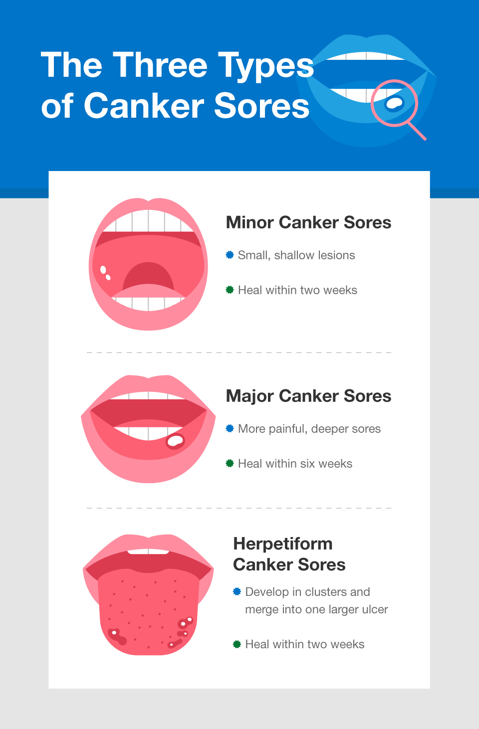 canker-sores-exploring-biology